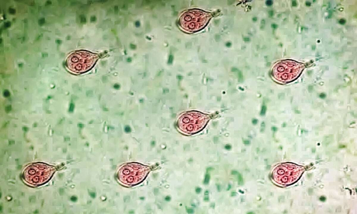 At-Home Parasite Testing: What Stool PCR Can and Can't Find